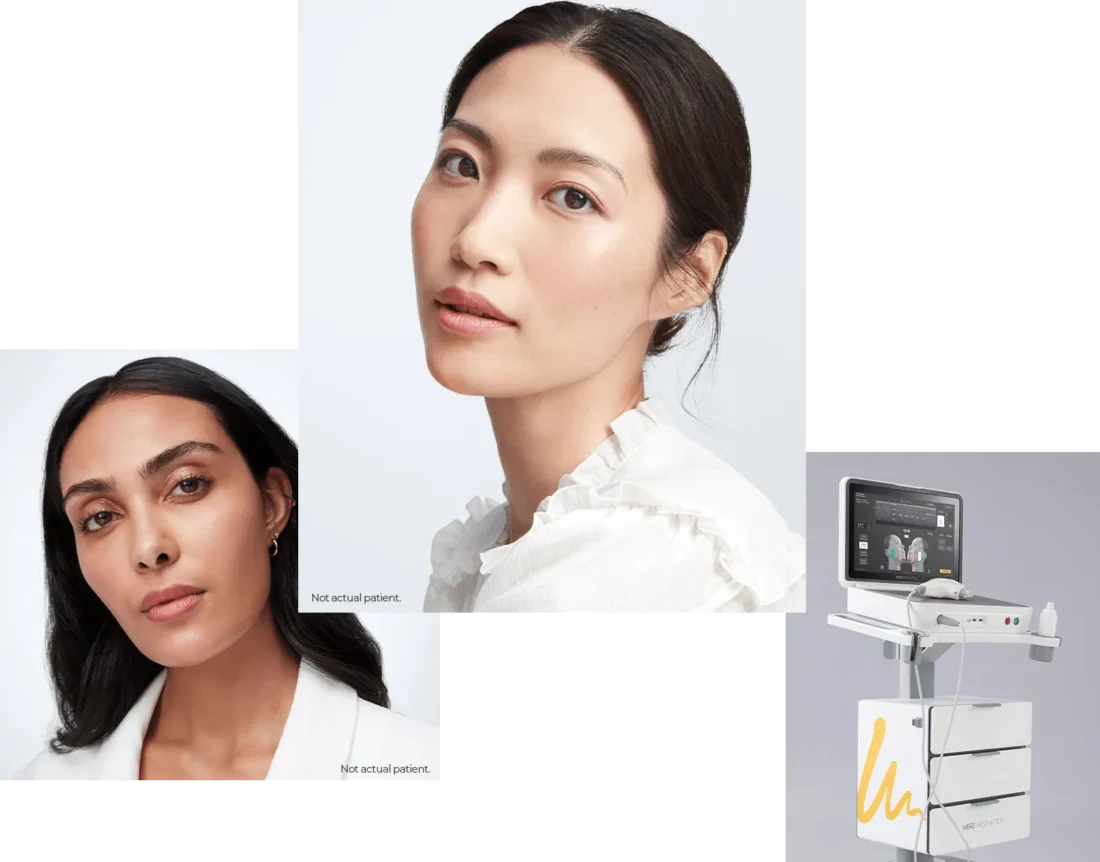 Ultherapy Geelong
