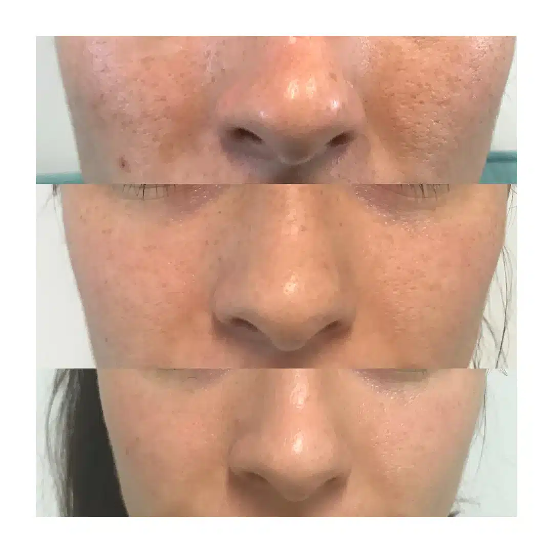 Zencell Restore Serum 15ml - Image 2